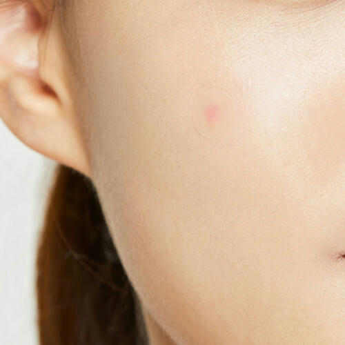 Cosrx Патчи против акне прозрачные - Acne pimple master patch, 24шт — изображение 3